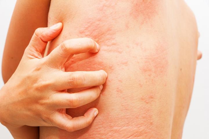Are Cold Showers Good For You?